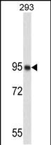 WB - NUCL Antibody AM1824a